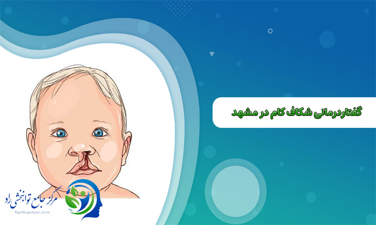 گفتاردرمانی شکاف کام در مشهد