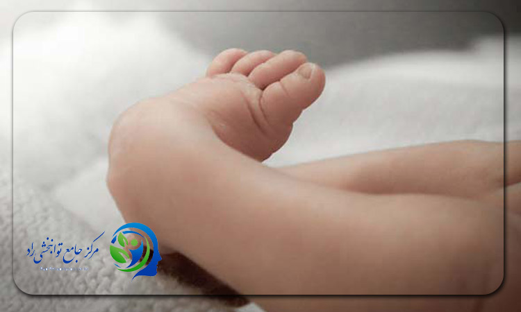 پا چنبری
