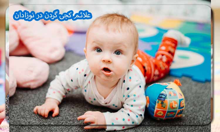 علائم کجی گردن در نوزادان