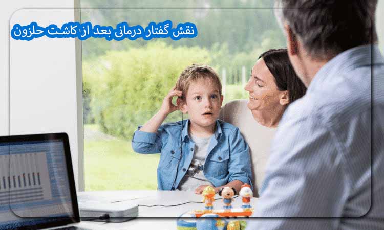 نقش گفتار درمانی بعد از کاشت حلزون