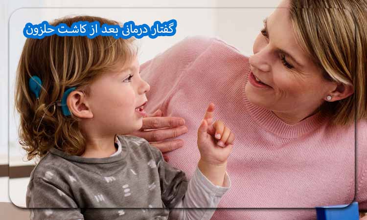 گفتار درمانی بعد از کاشت حلزون