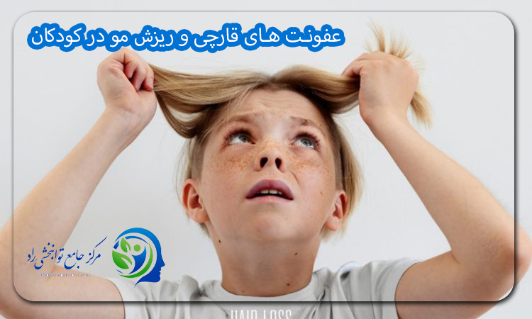 عفونت‌ های قارچی و ریزش مو در کودکان