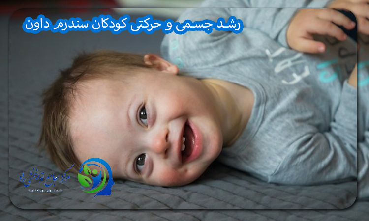 رشد جسمی و حرکتی کودکان سندرم داون