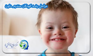 مراحل رشد کودکان سندرم داون