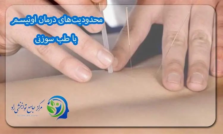 محدودیت های درمان اوتیسم با طب سوزنی
