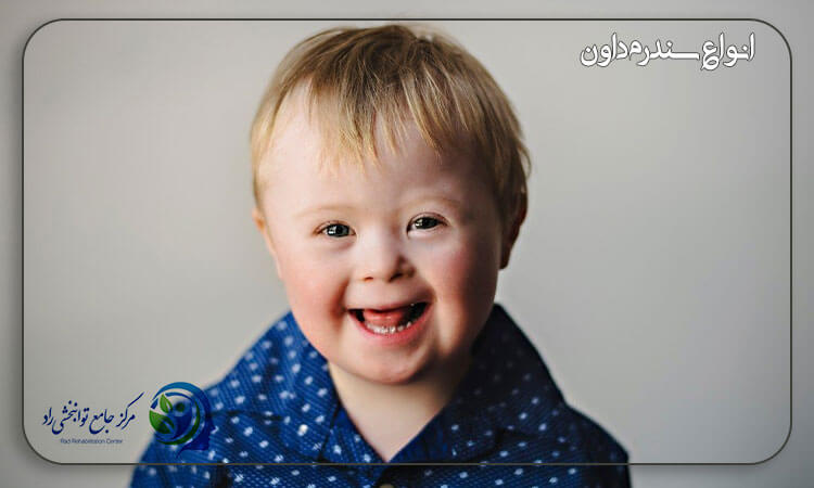 انواع سندرم داون