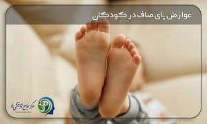 عوارض کف پای صاف در کودکان