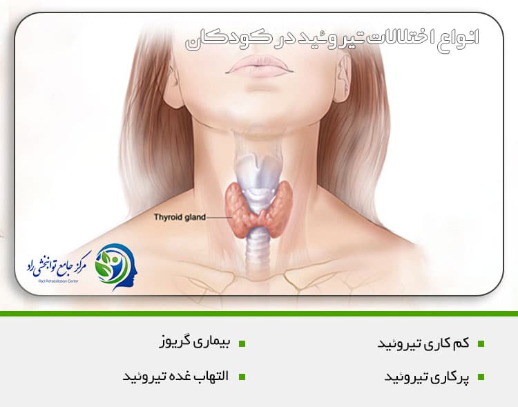 انواع اختلالات تیروئید در کودکان