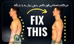 درمان قوز کمر