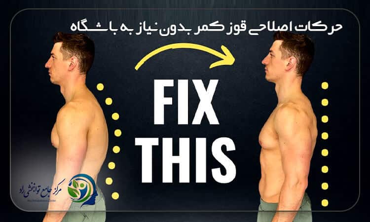 درمان قوز کمر