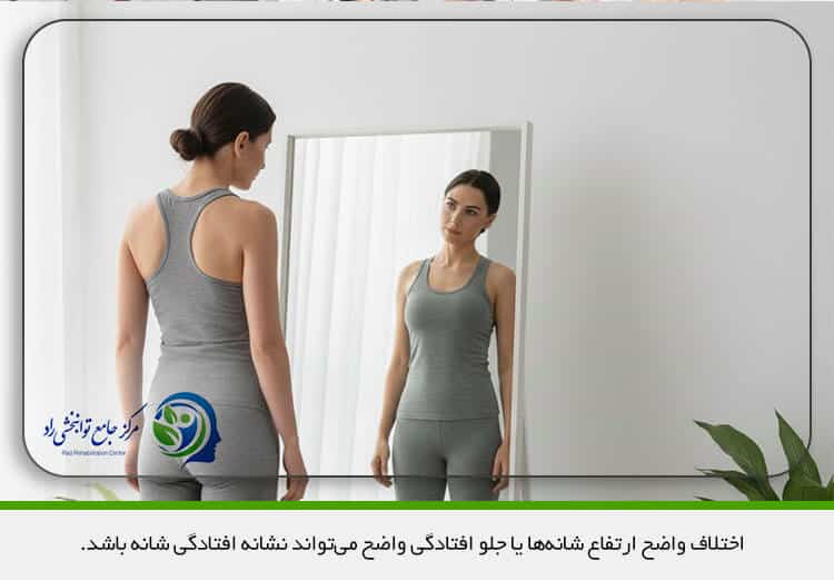 تشخیص افتادگی شانه