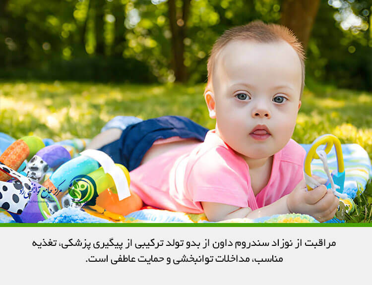 مراقبت از نوزاد سندروم داون از بدو تولد
